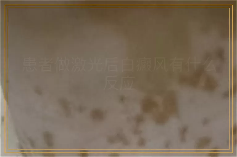 患者做激光后白癜风有什么反应