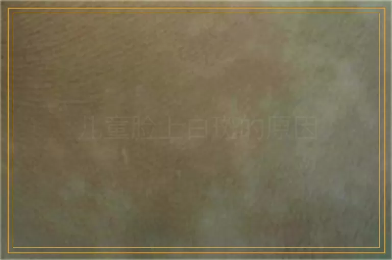 儿童脸上白斑的原因