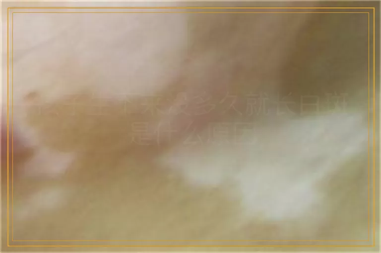 孩子生下来没多久就长白斑是什么原因