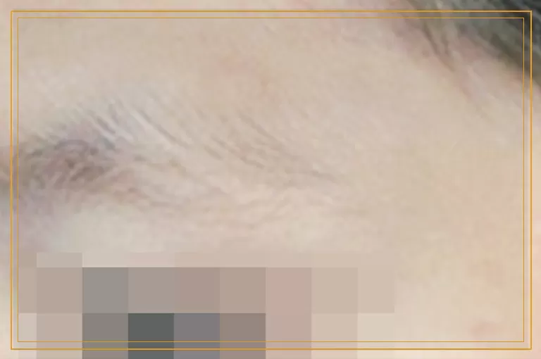 2岁宝宝脸上一片片白什么原因