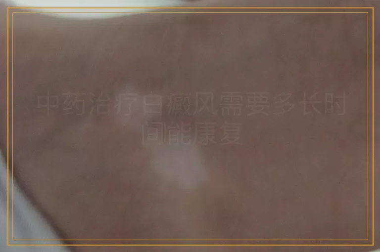 中药治疗白癜风需要多长时间能康复