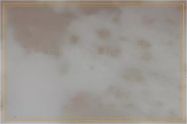 大腿上有几个白点是不是白癜风