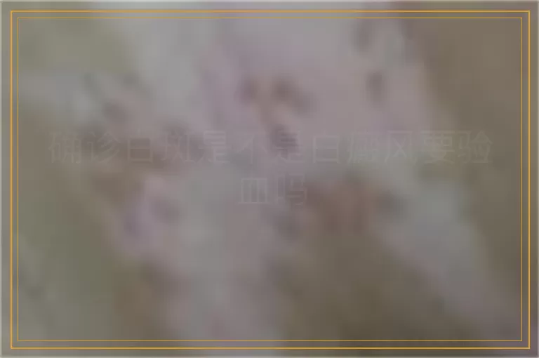 确诊白斑是不是白癜风要验血吗