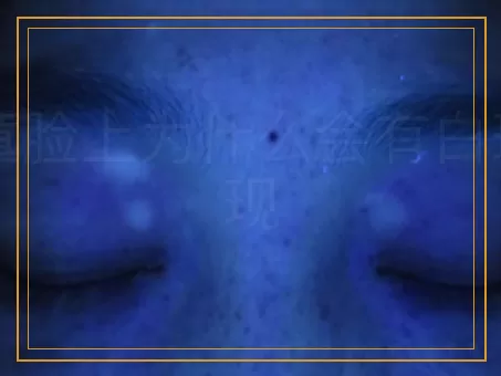 儿童脸上为什么会有白斑出现