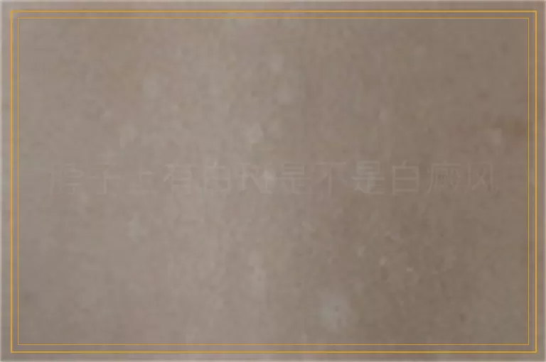 脖子上有白斑是不是白癜风