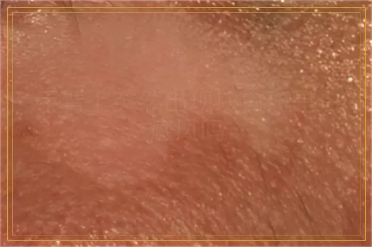 手臂上突然出现块白斑是白癜风吗