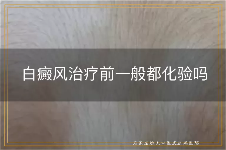 白癜风治疗前一般都化验吗
