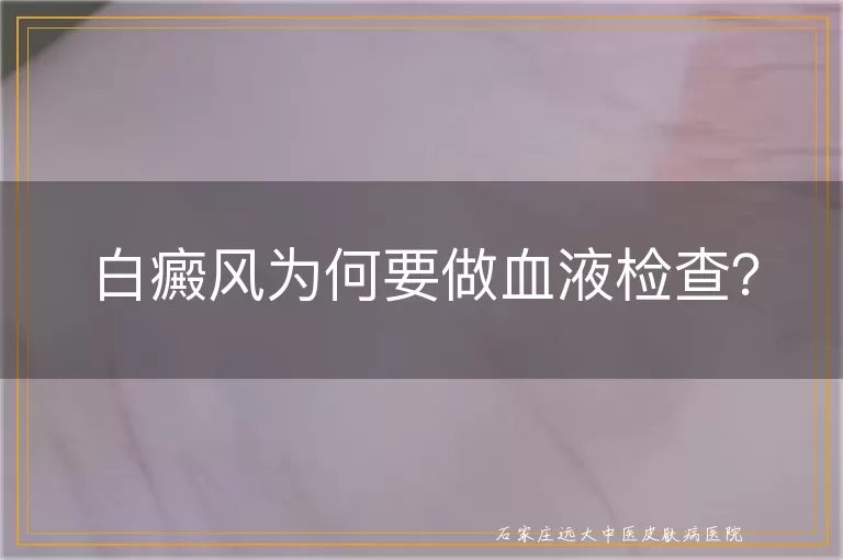 白癜风为何要做血液检查？