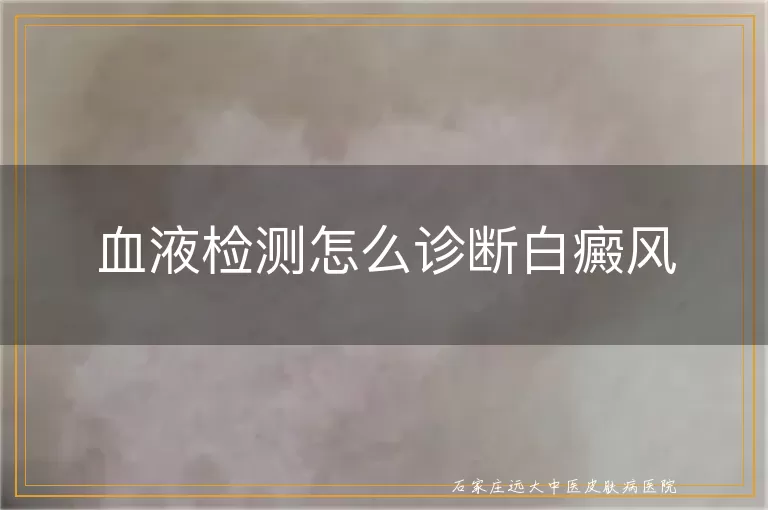 血液检测怎么诊断白癜风