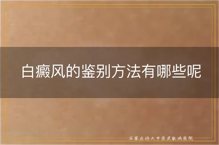白癜风的鉴别方法有哪些呢
