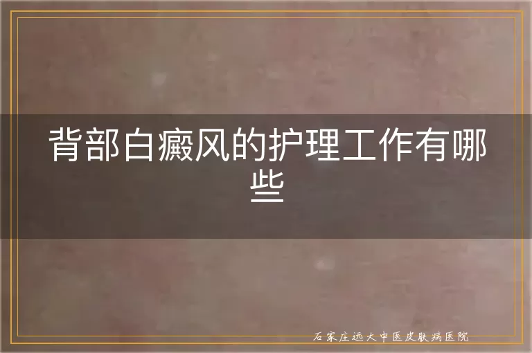 背部白癜风的护理工作有哪些