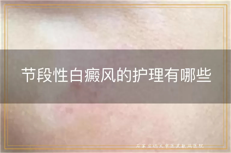 节段性白癜风的护理有哪些