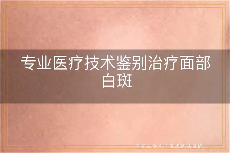 专业医疗技术鉴别治疗面部白斑