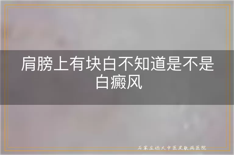 肩膀上有块白不知道是不是白癜风