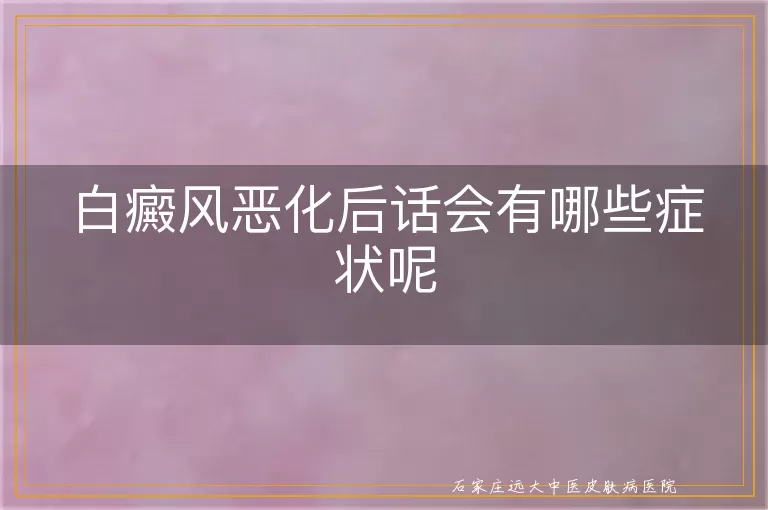 白癜风恶化后话会有哪些症状呢