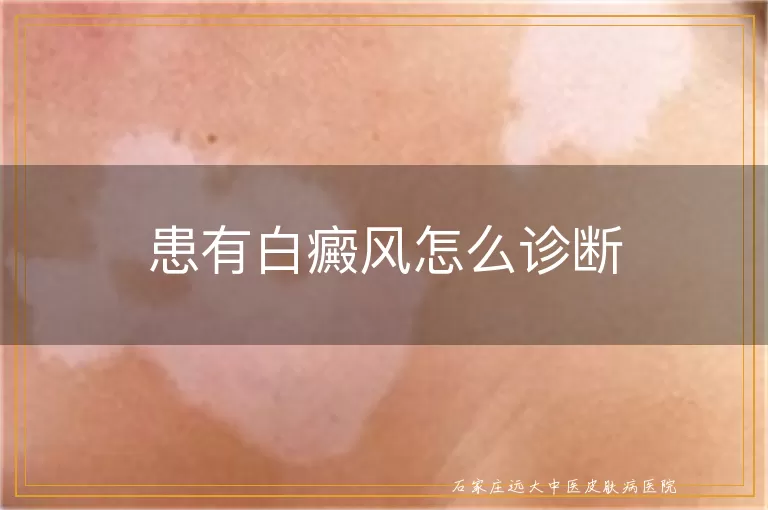 患有白癜风怎么诊断