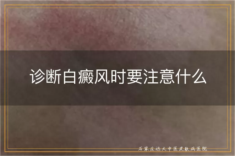 诊断白癜风时要注意什么