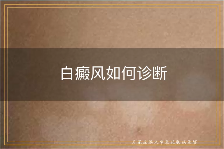 白癜风如何诊断