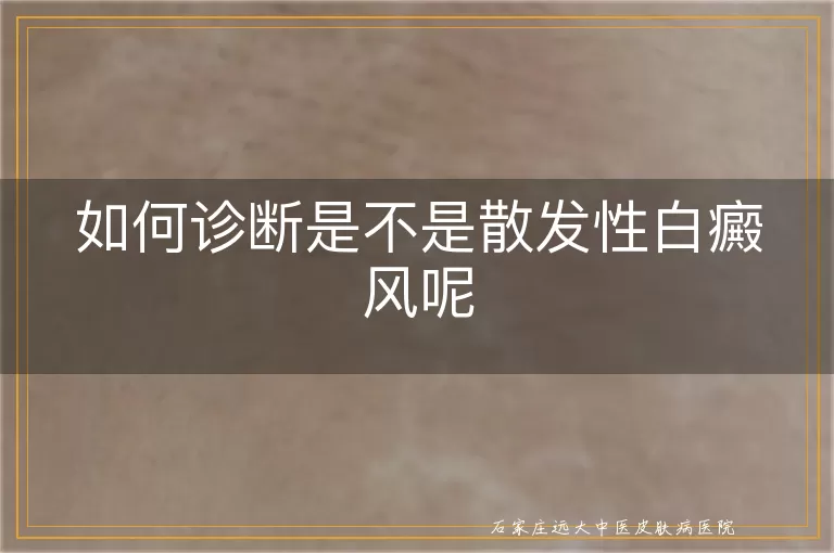 如何诊断是不是散发性白癜风呢
