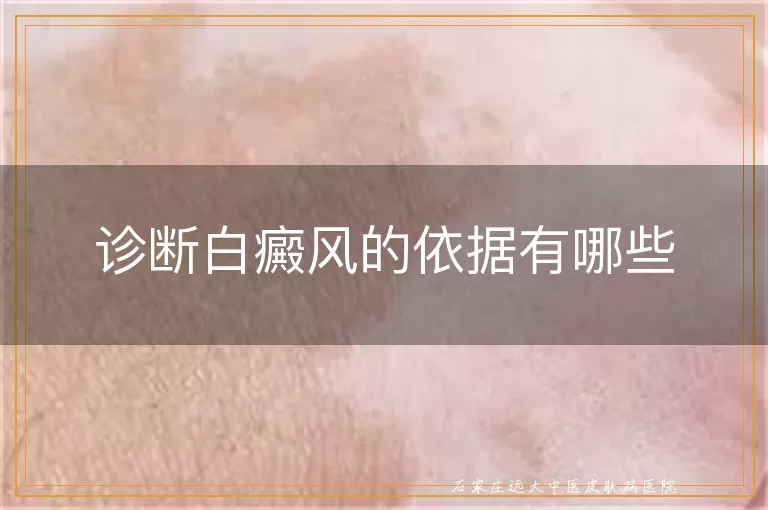诊断白癜风的依据有哪些