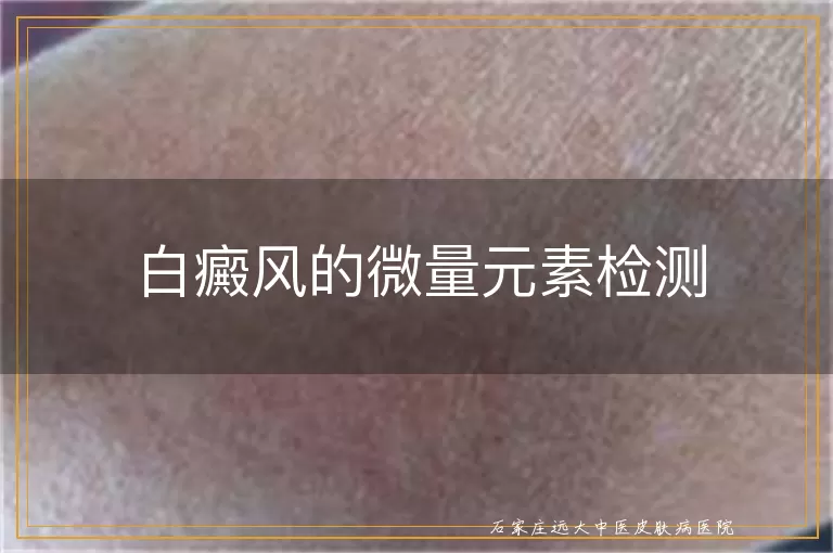 白癜风的微量元素检测