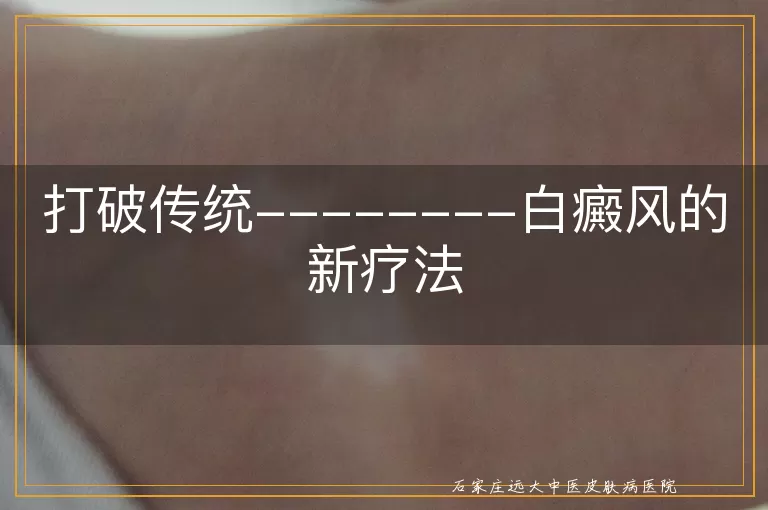 <strong>打破传统--------白癜风的新疗法</strong>