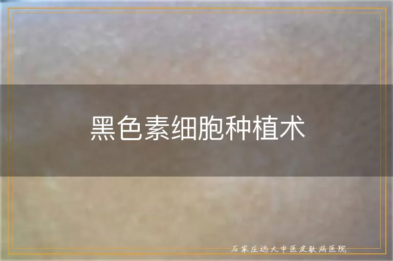 黑色素细胞种植术