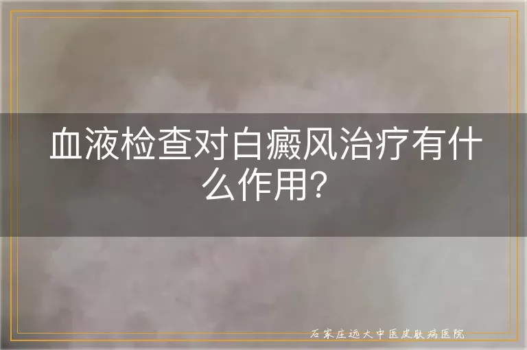 血液检查对白癜风治疗有什么作用？