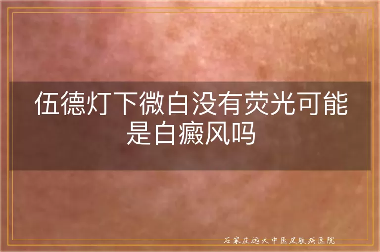 伍德灯下微白没有荧光可能是白癜风吗