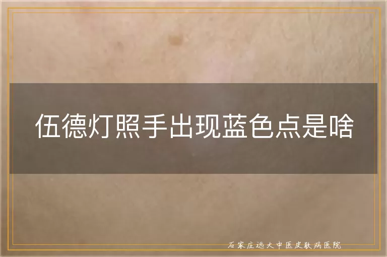 伍德灯照手出现蓝色点是啥