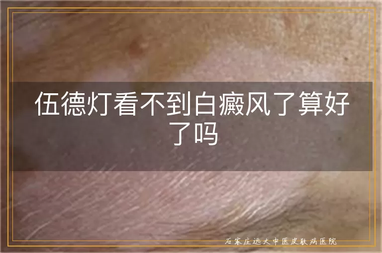 伍德灯看不到白癜风了算好了吗