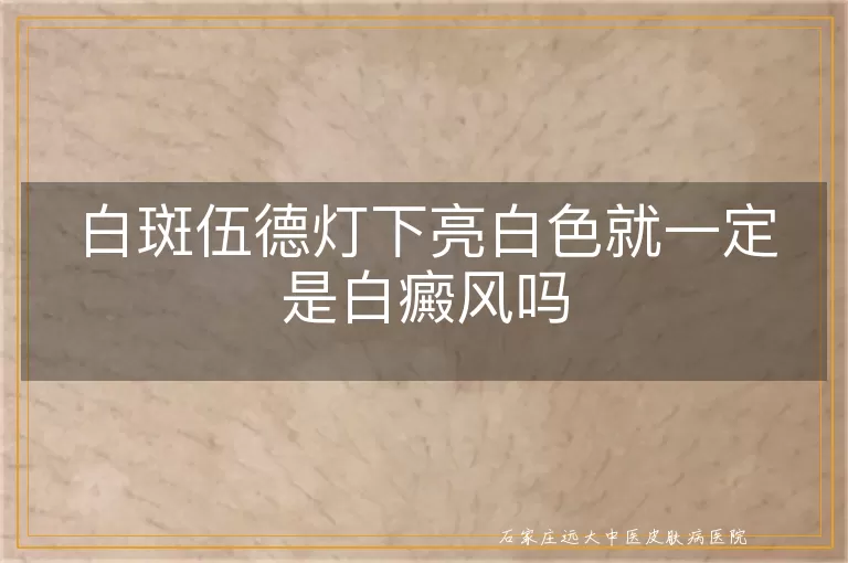 白斑伍德灯下亮白色就一定是白癜风吗