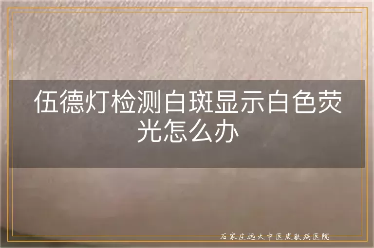 伍德灯检测白斑显示白色荧光怎么办