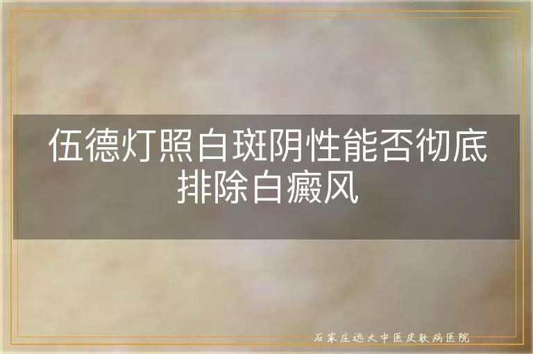 伍德灯照白斑阴性能否彻底排除白癜风