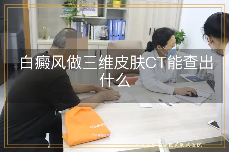 白癜风做三维皮肤CT能查出什么