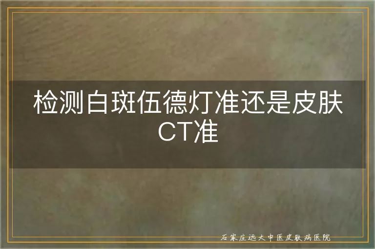 检测白斑伍德灯准还是皮肤CT准