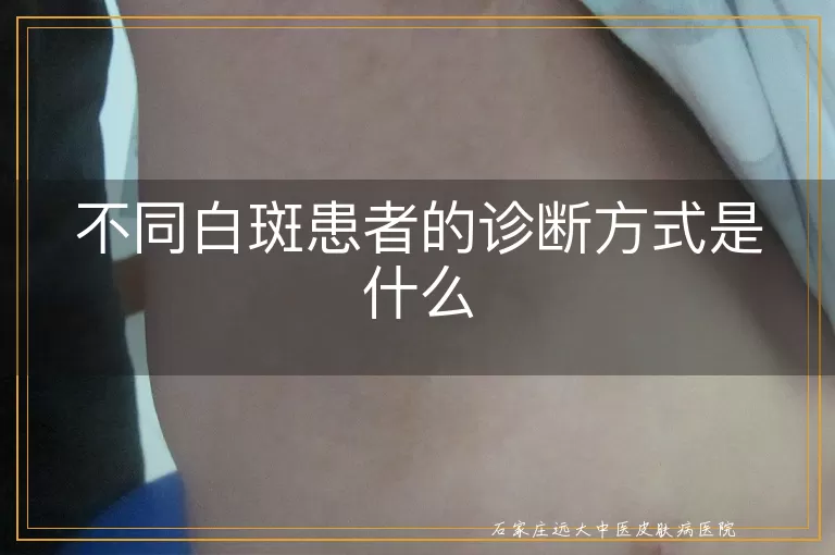 不同白斑患者的诊断方式是什么
