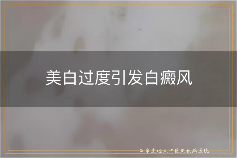 美白过度引发白癜风