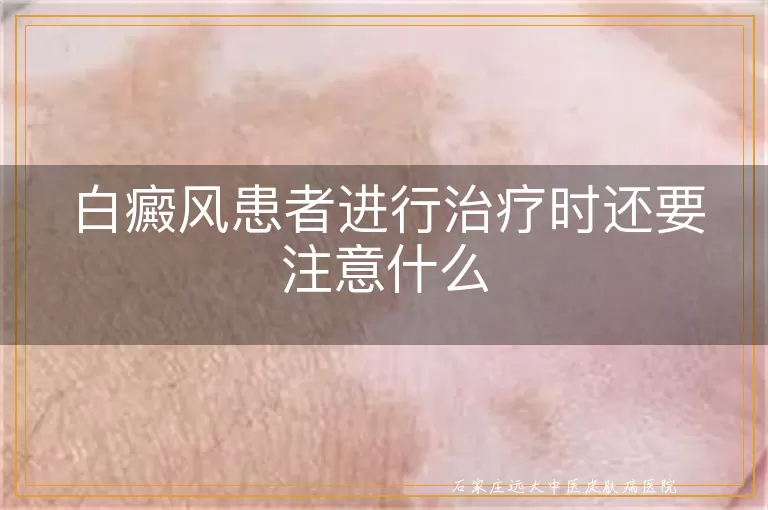 白癜风患者进行治疗时还要注意什么