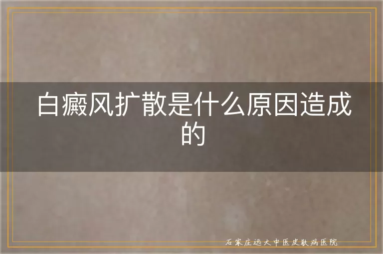 白癜风扩散是什么原因造成的