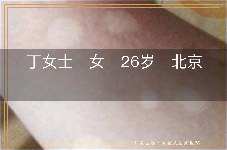 丁女士   女   26岁   北京