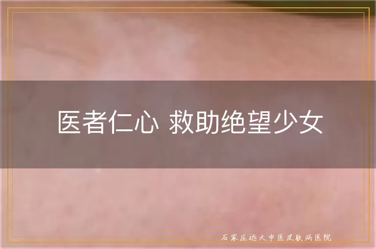 医者仁心 救助绝望少女