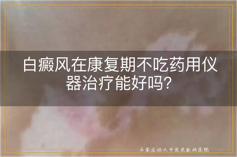 白癜风在康复期不吃药用仪器治疗能好吗？
