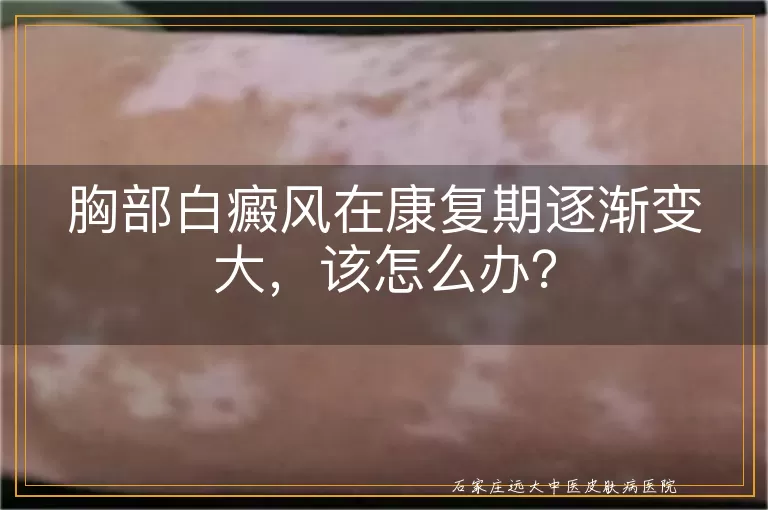 胸部白癜风在康复期逐渐变大,该怎么办?