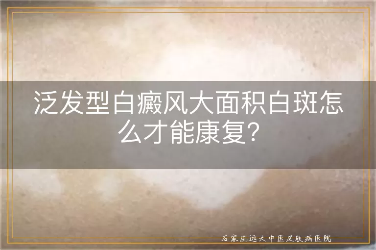 泛发型白癜风大面积白斑怎么才能康复？