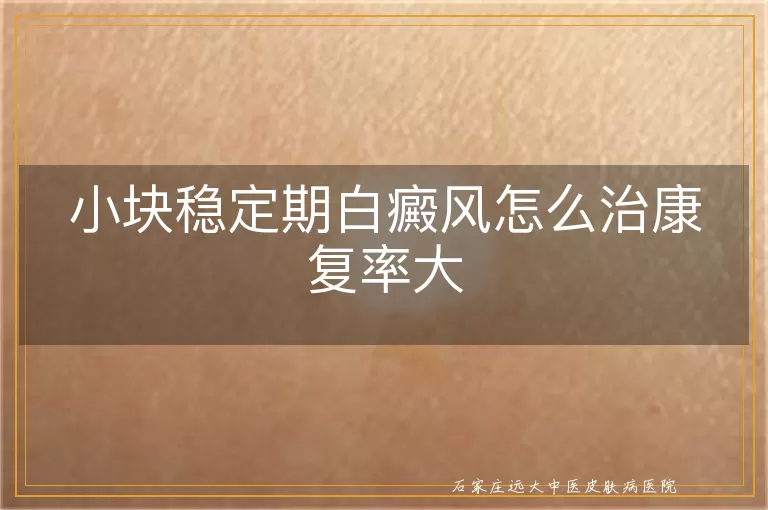 小块稳定期白癜风怎么治康复率大