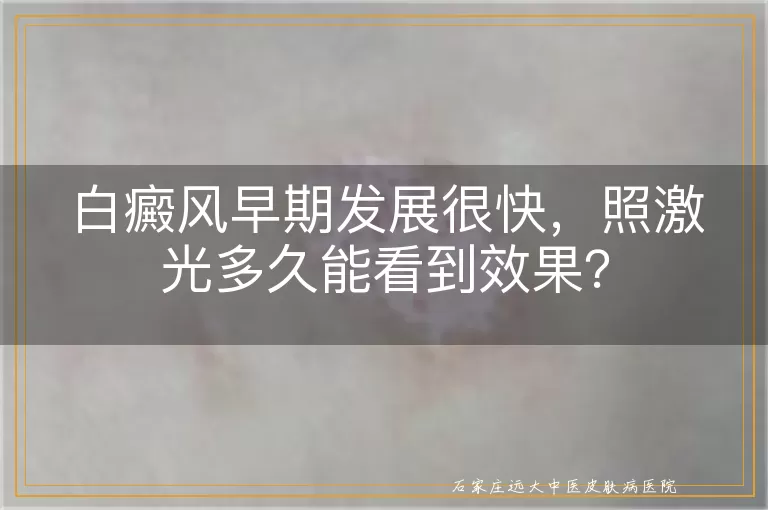 白癜风早期发展很快，照激光多久能看到效果？