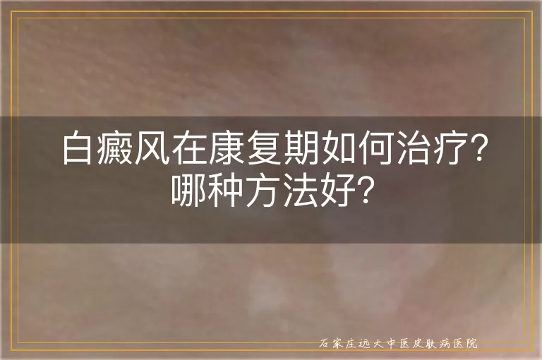 白癜风在康复期如何治疗？哪种方法好？