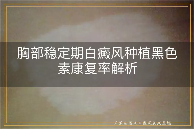 胸部稳定期白癜风种植黑色素康复率解析