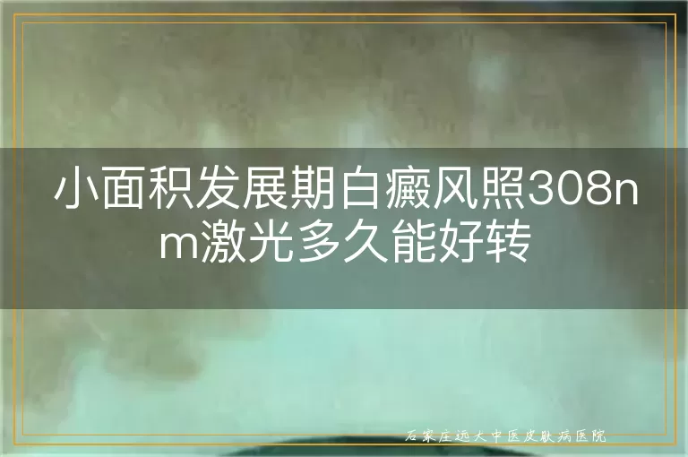 小面积发展期白癜风照308nm激光多久能好转